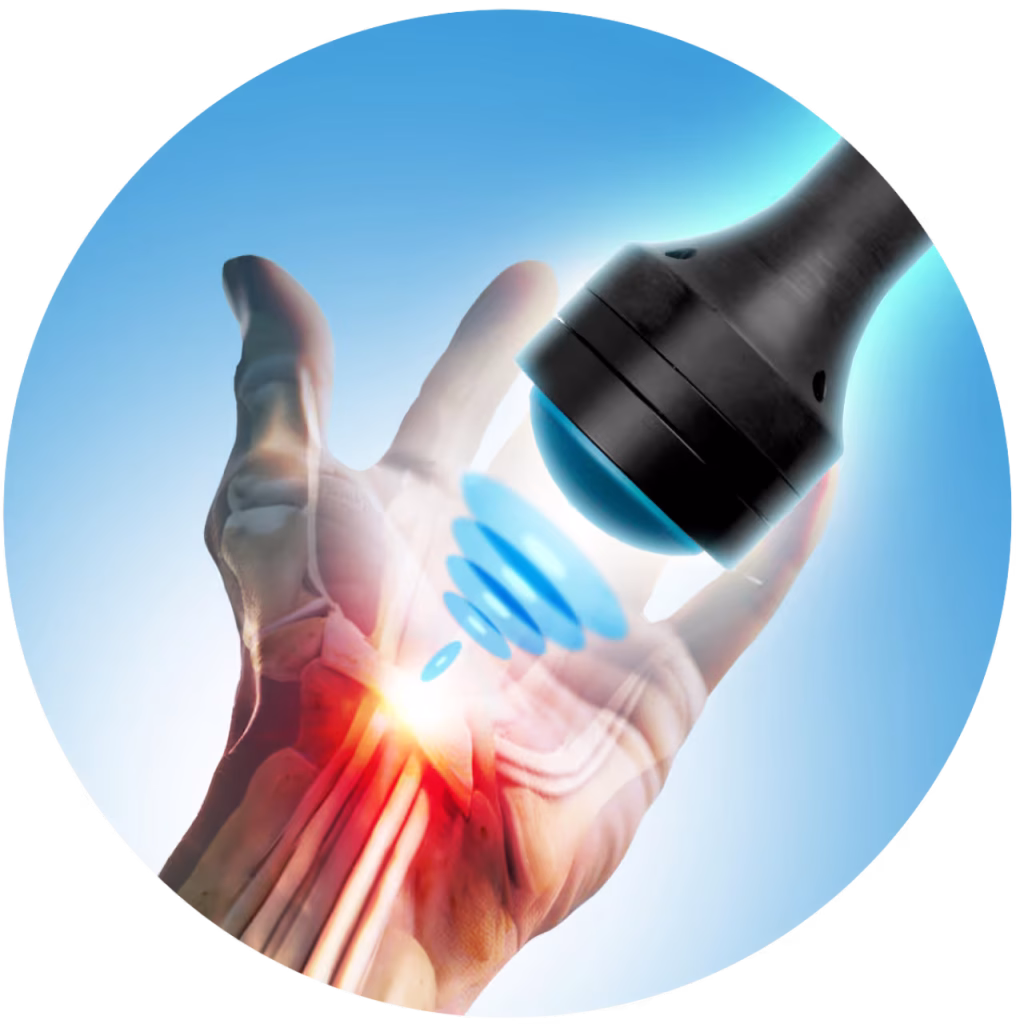 “Diagram showing how CellSonic therapy works: energy pulses targeting damaged tissue to stimulate cell repair, reduce inflammation, and accelerate healing through non-invasive bioelectric and acoustic waves.